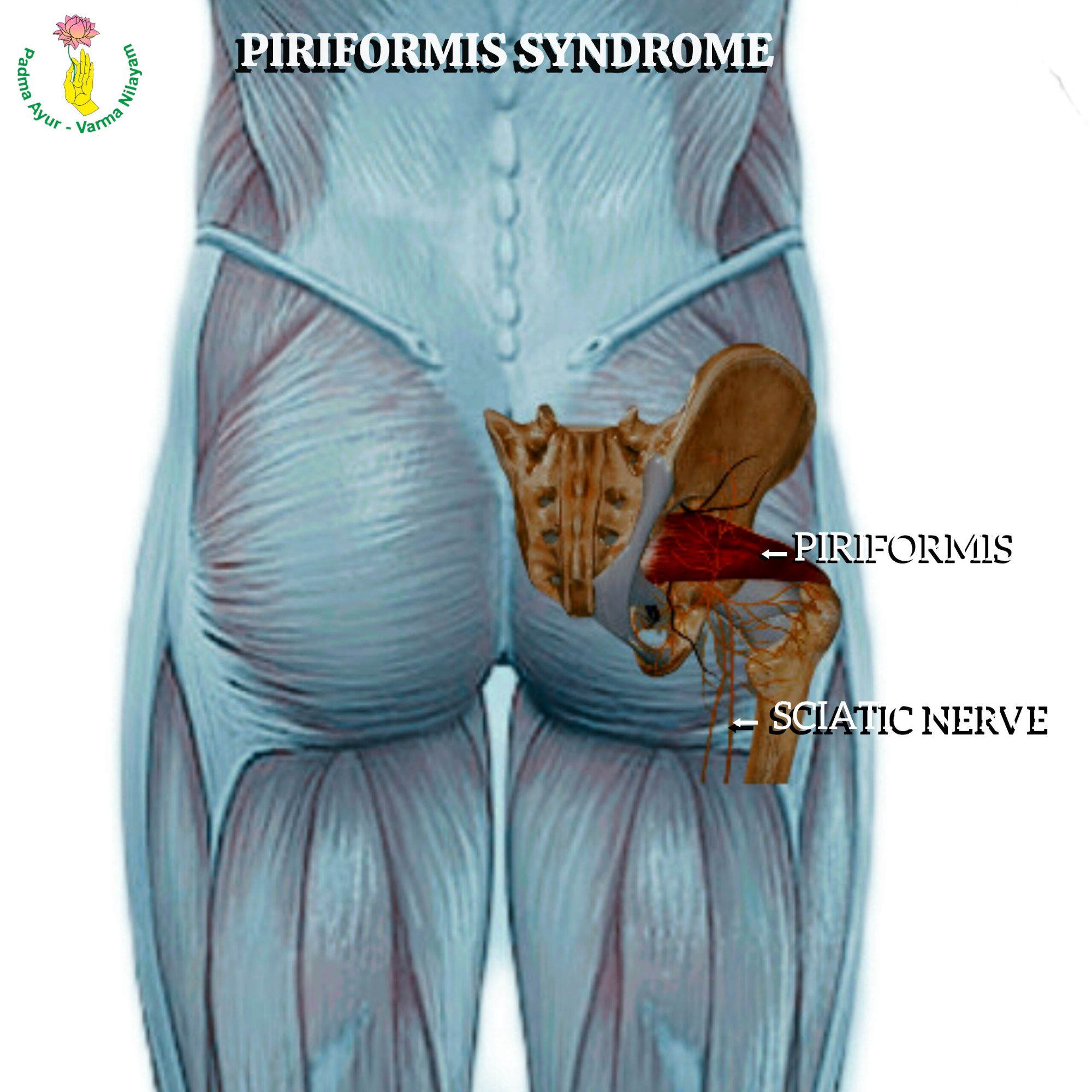 Superimposed image showing Pyriformis muscle & sciatic nerve over the surface of gluteus of a standing person.